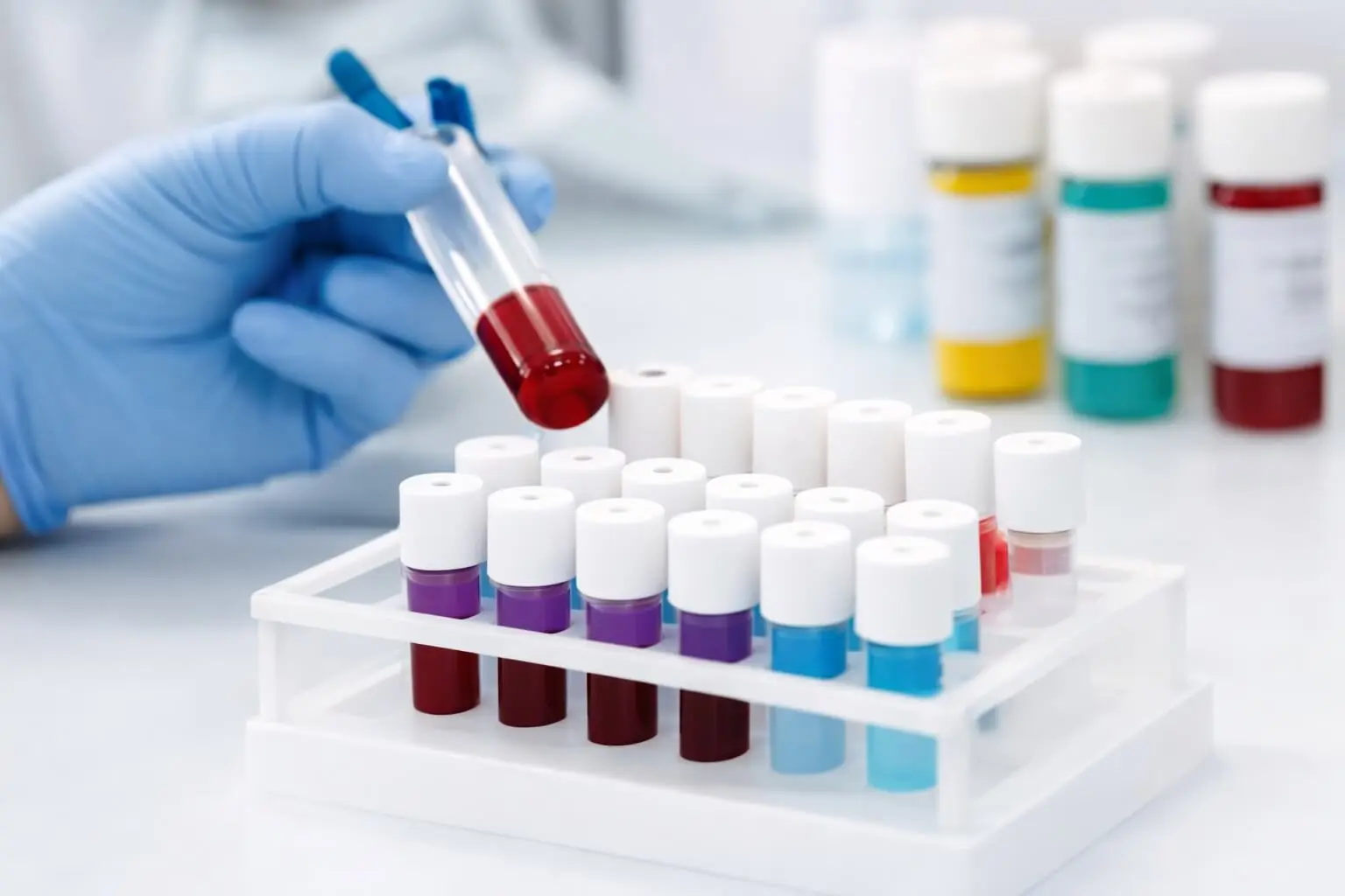 Lab test and ECG at home Electronic City Bangalore